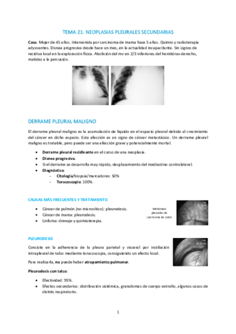 T21-Neoplasias-pleurales-secudarias.pdf