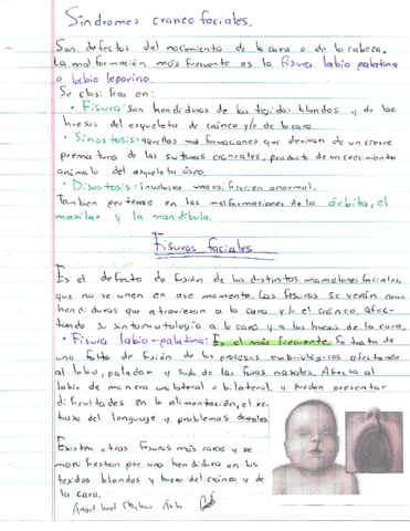Sindromes-Craneofaciales.pdf