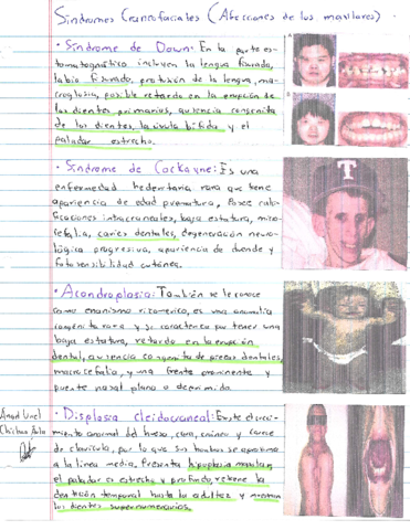 Sindromes-Craneofaciales-Afecciones-a-los-maxilares.pdf