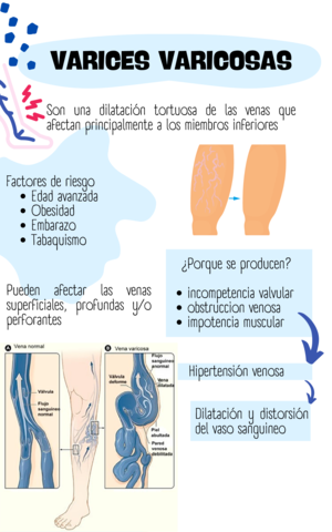 varices-varicosas.pdf