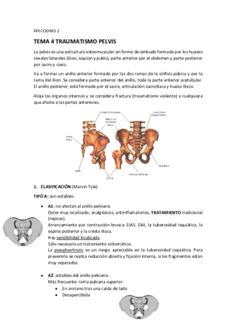 TEMAS-OSW-14-Traumatismo-Pelvis.pdf