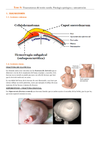 TEMA-8-Traumatismos-del-recien-nacido.pdf