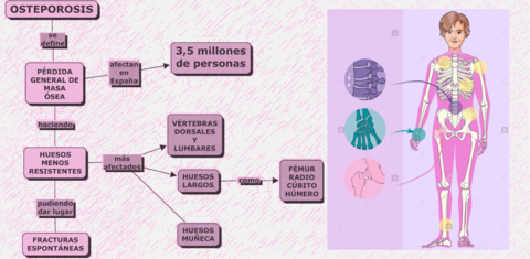 OSTEOPOROSIS.pdf