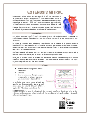 estenosis-mitral.pdf