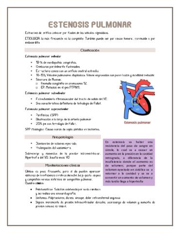 Estenosis-pulmonar.pdf