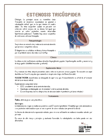 estenosis-tricuspidea.pdf