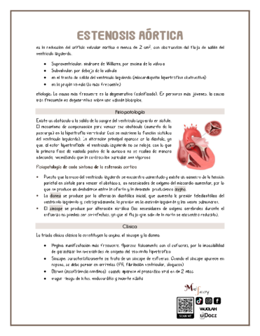 Estenosis-aortica.pdf