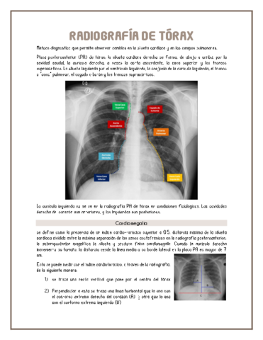 radiografia-de-torax.pdf