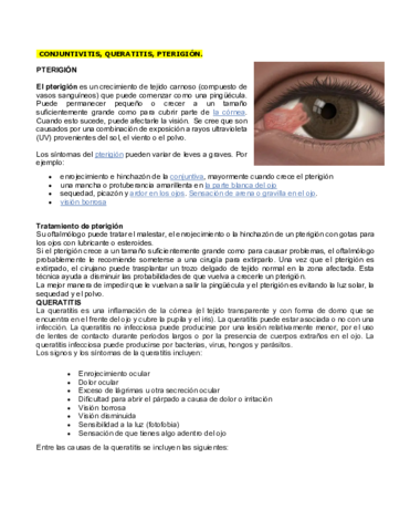 CONJUNTIVITIS-QUERATITIS-PTERIGION.pdf