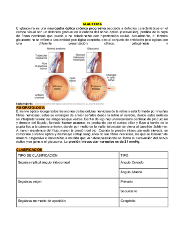 GLAUCOMA.pdf