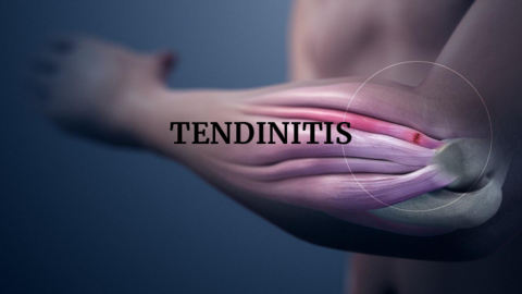 tendinitis.pdf