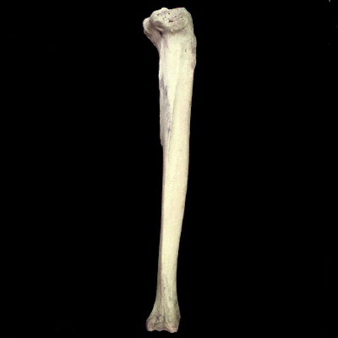 tibia lateral.jpg