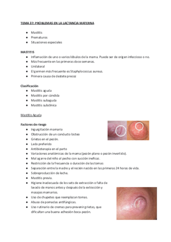 TEMA-37-PROBLEMAS-EN-LA-LACTANCIA-MATERNA.pdf