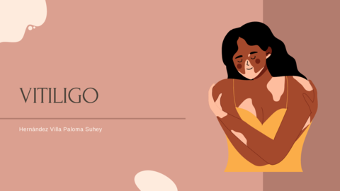 Vitiligo.pdf