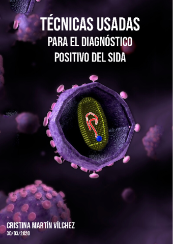 TECNICAS-USADAS-PARA-EL-DIAGNOSTICO-POSITIVO-DEL-SIDA1.pdf