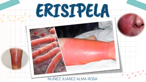 ERISIPELA.pdf