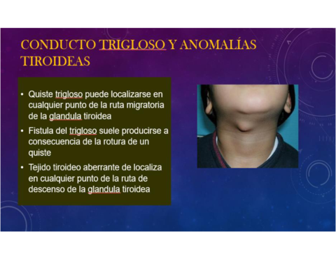 Conducto-trigloso.pdf