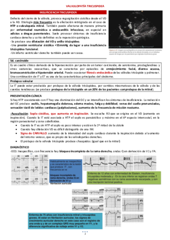 VALVULOPATIA-TRICUSPIDEA.pdf