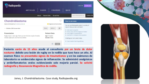 CASO-CLINICO-CONDROBLASTOMA-RADIOLOGIA.pdf
