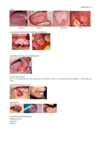 PMB-TEMA-15.pdf