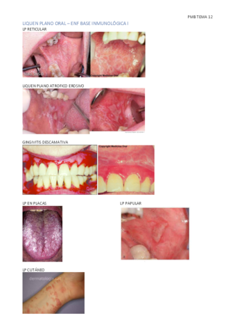 PMB-TEMA-12-I-Y-II.pdf