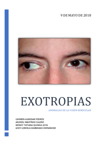 EXOTROPIAS-ANOMALIAS-DE-LA-VISION.pdf