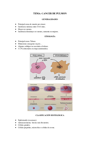 Cancer-de-pulmon.pdf