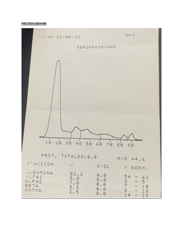 practica-proteinogramacelogelrefractometro-portatil.pdf