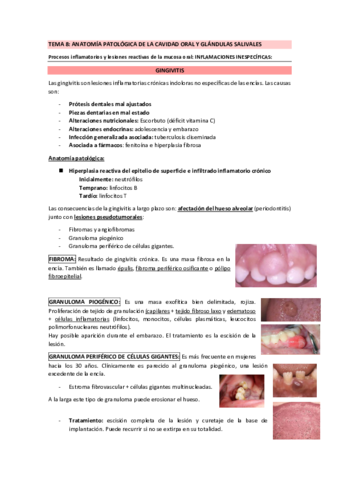TEMA-8-ANATOMIA-PATOLOGICA-DE-LA-CAVIDAD-ORAL-Y-GLANDULAS-SALIVALES.pdf
