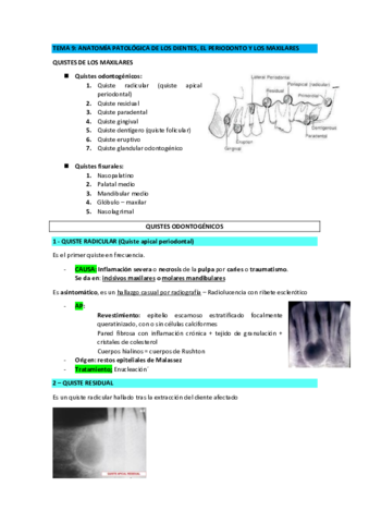 TEMA-9-quistes-y-tumores-de-los-maxilares-1.pdf