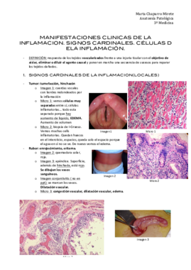 1. MANIFESTACIONES CLINICAS DE LA INFLAMACION.pdf