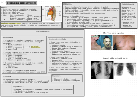Sds-mediastinics.pdf
