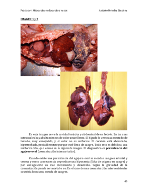 Práctica 4. Miocardio endocardio y vasos COMPLETA.pdf
