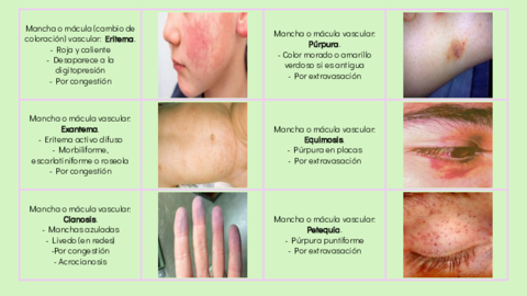 Flashcard-Lesiones-dermatologicas.pdf