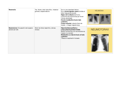 Resumen-patologia-rx-torax-patologia-3o-med.pdf