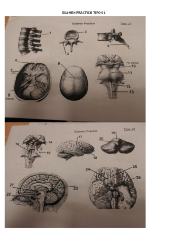 Exam-Practico-Neuro.pdf
