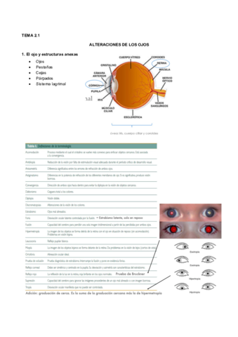 2.1 Alteración en los ojos