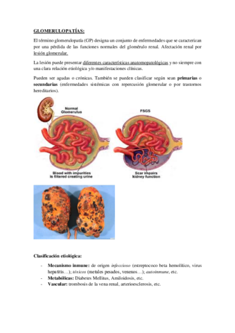 GLOMERULOPATIAS.pdf
