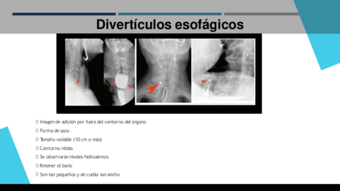 Patologias-esofagicas-.pdf