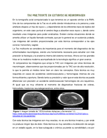 TAC-MULTICORTE.pdf