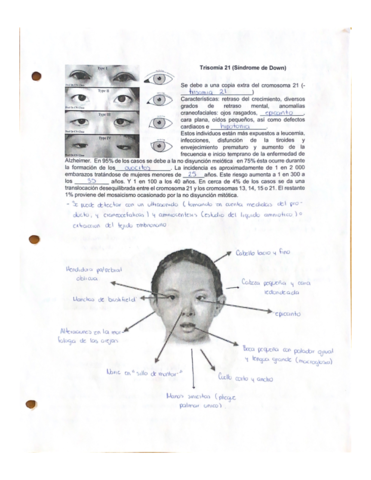 Sindromes-Cromosomicos.pdf