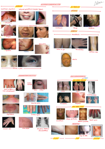 Segundo-parcial-Dermatologia-.pdf