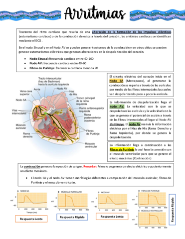 ARRITMIAS.pdf