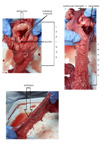 Practica-pulmones.pdf