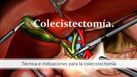 tecnica-de-colecistectomia-.pdf