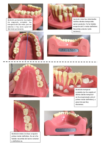 tipo-de-denticion.pdf