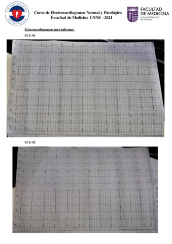 Electrocardiograma-Ejemplos.pdf