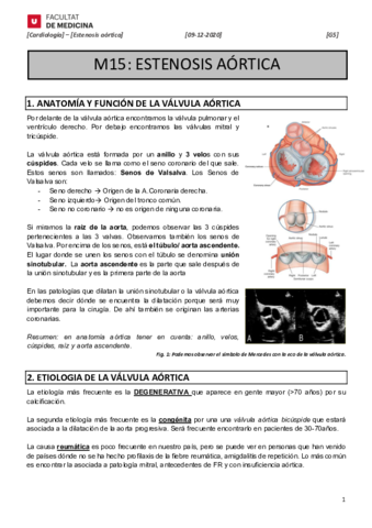 M15-ESTENOSIS-AORTICA.pdf