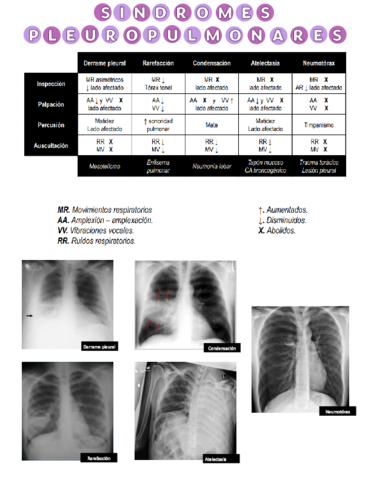 Sindromes-pleuropulmonares.pdf