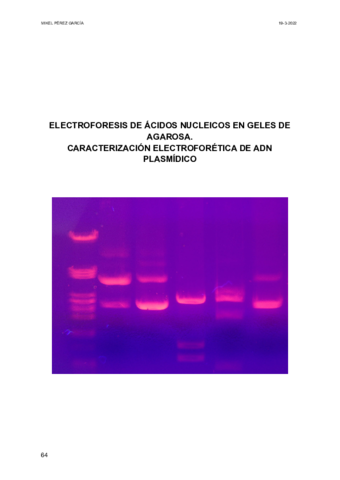 7-ELECTROFORESIS-DE-ACIDOS-NUCLEICOS-EN-GELES-DE-AGAROSA.pdf